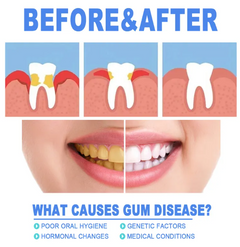 Healthy Gums & Teeth Repair Gel